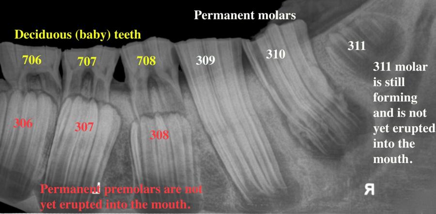 Intraoral Radiograph of a 2 year old horse, with notations